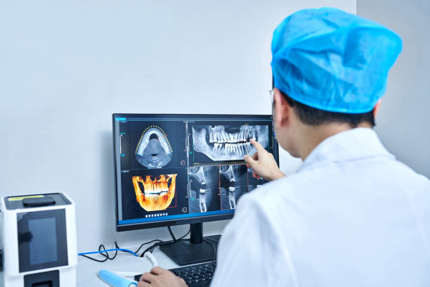Best Teeth Whitening  in Iowa, LA