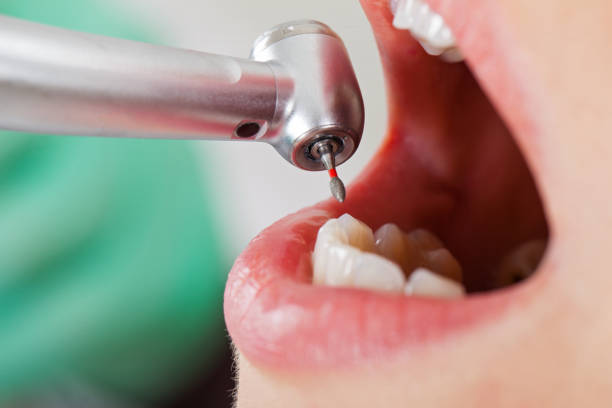 Best Emergency Dentist for Kids  in Iowa, LA